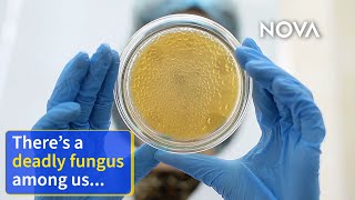 This Fungus Is Spreading Rapidly in Hospitals by NOVA PBS Official 25,224 views 1 year ago 3 minutes, 25 seconds