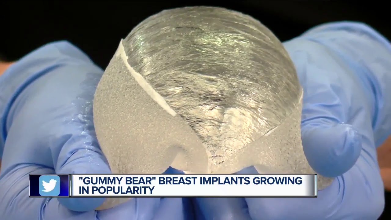 Why is the 'Gummy Bear' implant gaining popularity for breast
