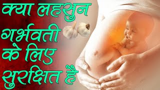 Is garlic safe for pregnant women क्या गर्भवती महिलाओं के लिए लहसुन खाना सुरक्षित है@PregnancyGyan