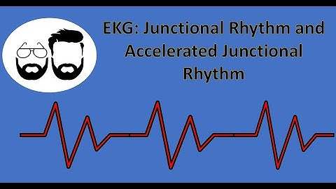 A high a-v junctional pacemaker là gì năm 2024