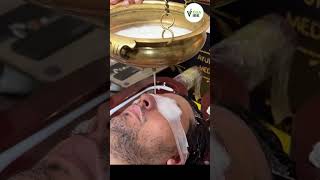Shirodhara Therapy: Ayurvedic Stress Relief for a Calm Mind &amp; Better Sleep