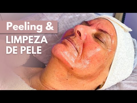 Vídeo: Como Aplicar o Peeling de Cultura de Pele: 14 etapas (com fotos)