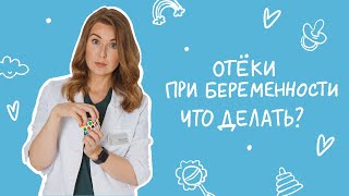 Что делать с отёками до и после родов | Отёки при беременности | Врач неонатолог | Мамам от Raduga