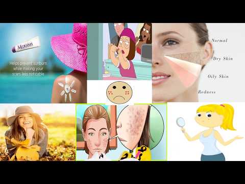 Mederma Scar Cream