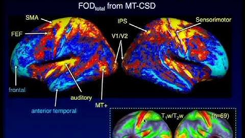 In vivo myelo-architecture using whole-brain diffusion MRI
