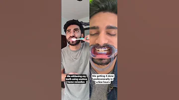 Sabka Dentist Recommends Our Revolutionary Teeth Cleaning Whitening Treatment For Strong Teeth 