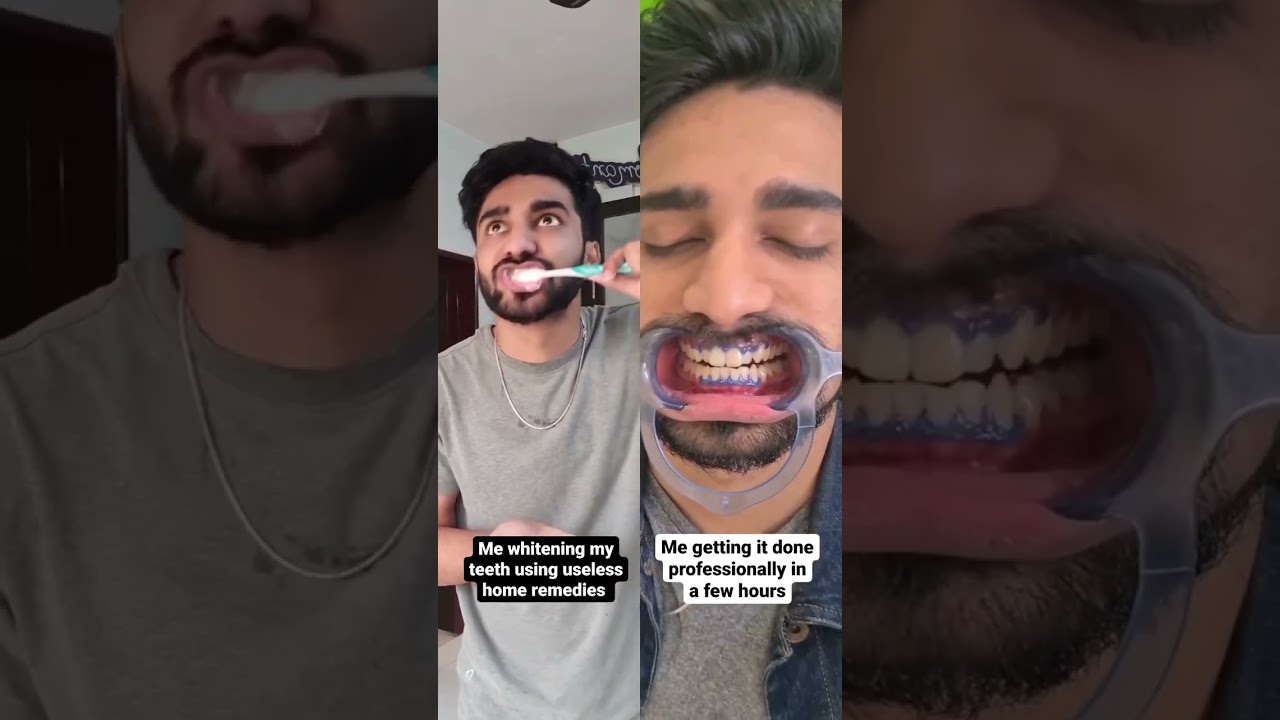 HOW MUCH do deep cleanings cost!? Dental Clinic