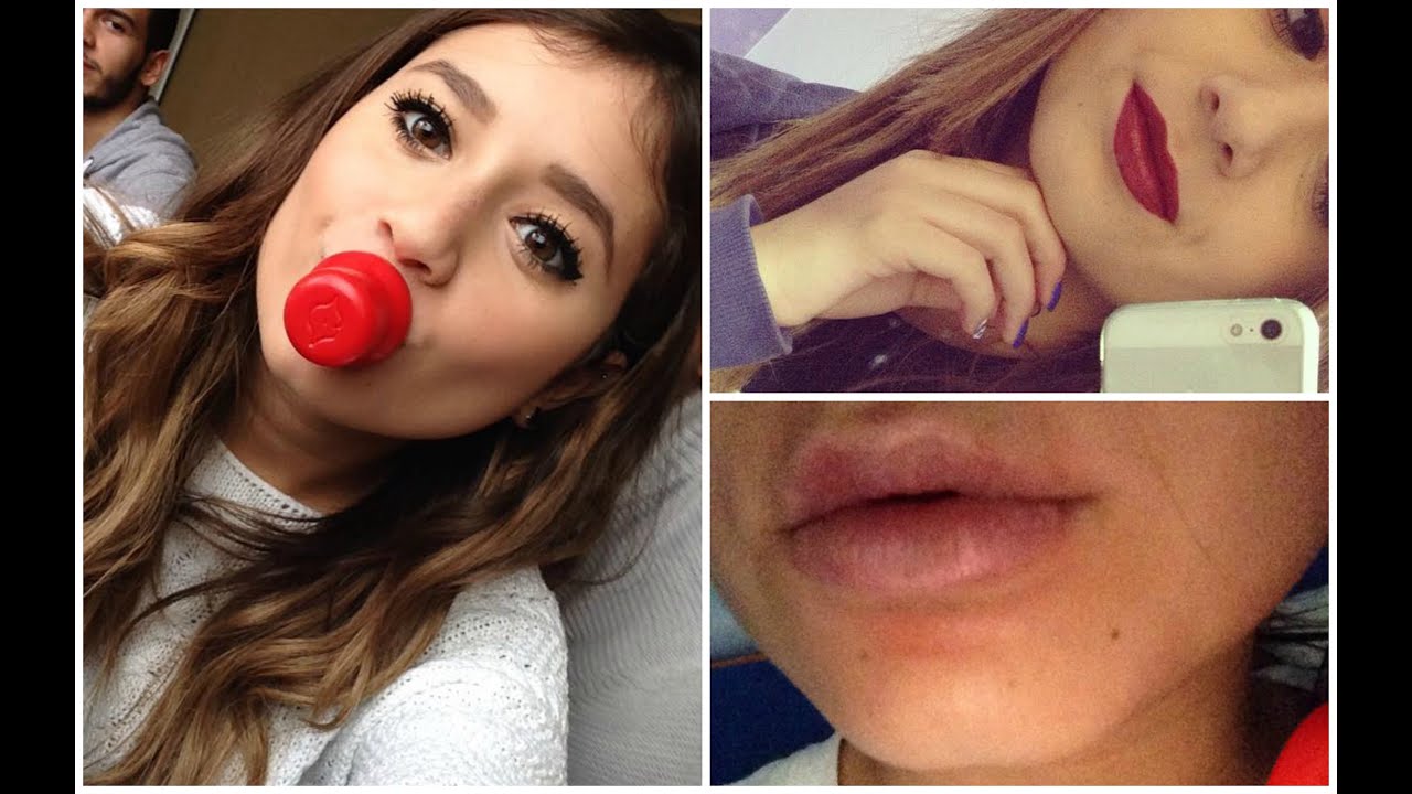 Labbra più grandi in pochi minuti? RECENSIONE DETTAGLIATA FULL LIPS!!!! YouTube Labbra più grandi in pochi minuti? RECENSIONE DETTAGLIATA FULL LIPS!!!! YouTube