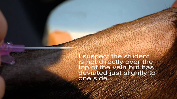 Insertion of an intravenous catheter