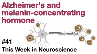 TWiN 41: Alzheimer&#39;s and melanin-concentrating hormone