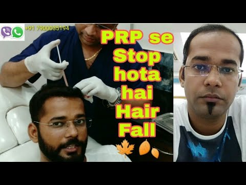 my-prp-session-to-reverse-hair-loss-||-platelet-rich-plasma-therapy