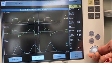 Servo I: Measuring P0.1, Pocc, and Delta-P