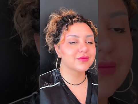 ساکشن غبغب کلینیک آوا زعفرانیه تلفن ۰۹۱۲۱۷۶۱۰۱۷ ۰۹۱۲۷۷۰۳۲۷۷