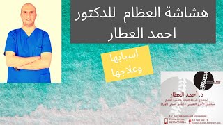 هشاشة العظام اسبابها وعلاجها للدكتور احمد العطار