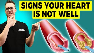 9 Signs You Have Clogged Arteries & Heart Problems [+7 Treatments] screenshot 1