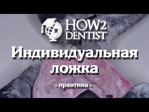 Как сделать индивидуальную ложку / How to Dentis