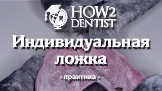Как сделать индивидуальную ложку / How to Dentis Как сделать индивидуальную ложку / How to Dentis