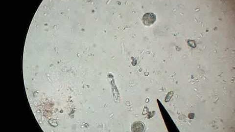 Amoeboid Motion