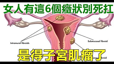 女人有这6个症状别死扛，是得“子宫肌瘤”了！最好少吃这个东西了！ - 天天要闻