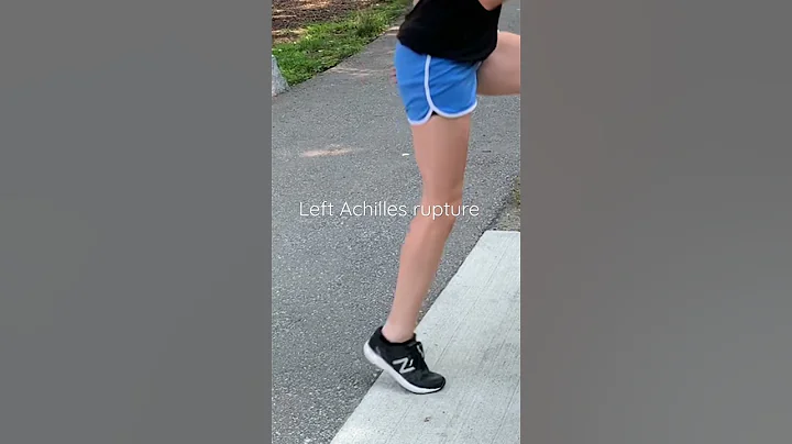 Achilles Tendon Rupture Caught on Camera