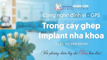 CÔNG NGHỆ ĐỊNH VỊ - GPS TRONG CẤY GHÉP IMPLANT NHA KHOA