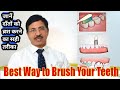 How to brush your teeth? दन्त ब्रश करने का सही तरीका: Ways to Brushing Teeth by Dr. Praveen Bhatia