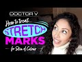 Doctor V - How to treat Stretch Marks for Skin of Colour | Brown or Black Skin