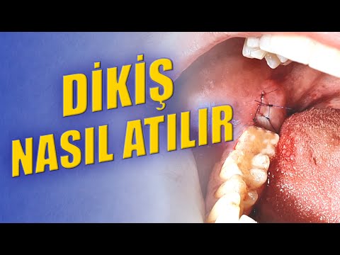 Video: Morel ve dikişler nasıl düzgün ve iyice durulanır ve kaynatılır