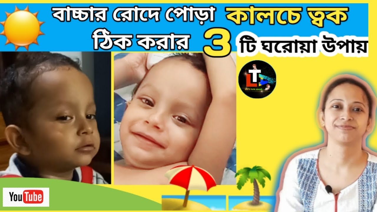 Baby Skin Care in Summer To Remove Sun Tan Home Remedy to Make Baby
