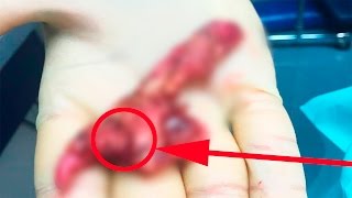 ЧТО БУДЕТ,ЕСЛИ ПРОГЛОТИТЬ ЖВАЧКУ? ЧТО БУДЕТ,ЕСЛИ ПРОГЛОТИТЬ ЖВАЧКУ?