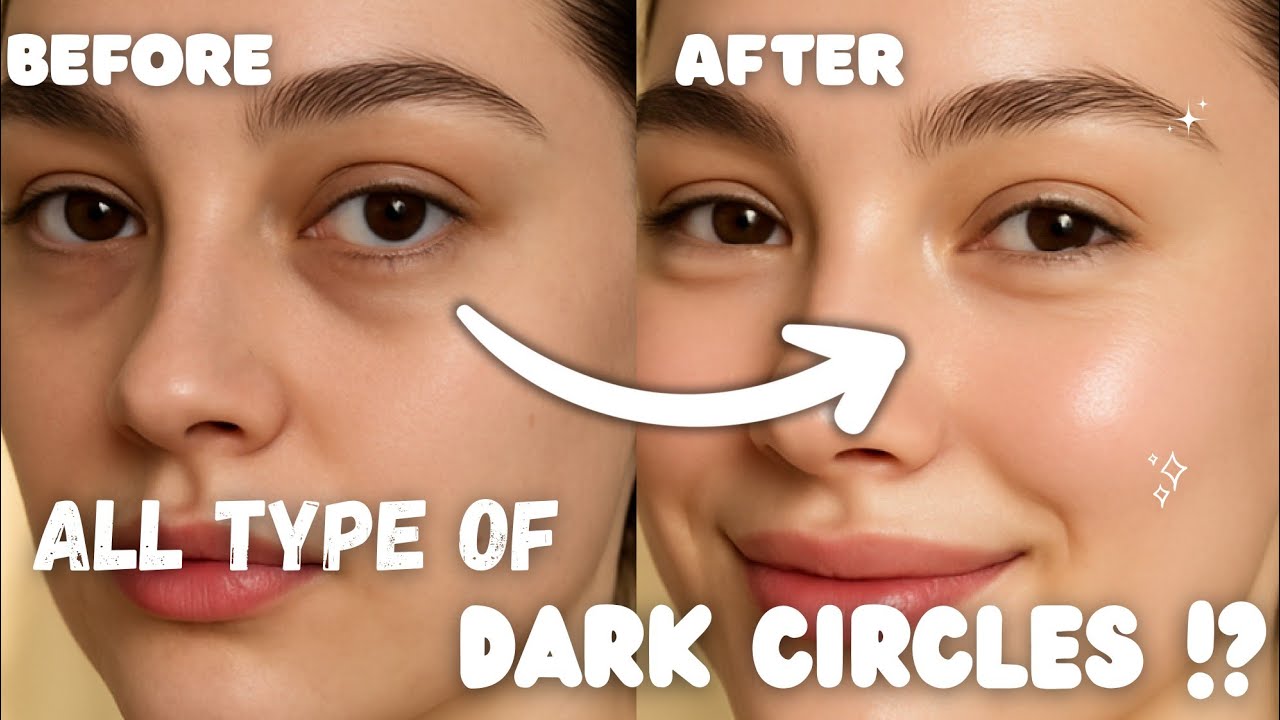 The most REALISTIC way to treat Dark Circles 👀  || Puffy eyes, Eye bags, Wrinkles & more ||