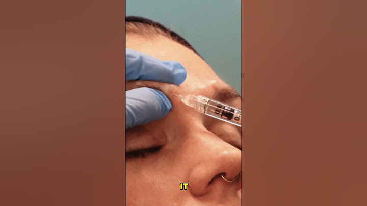 BOTOX FOR DEPRESSION and ANXIETY