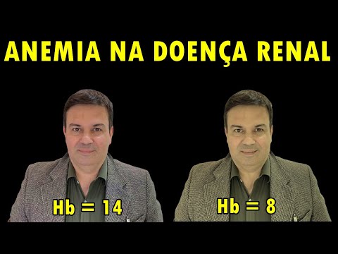 ANEMIA: Pode Ter