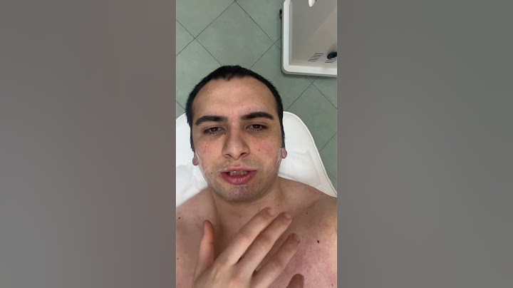 Делаю лазерную эпиляцию лица