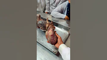 Human Heart Shorts Mbbs Viral Trending Heart Anatomy Medico Future Doctor Love 