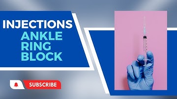 How to Perform an Ankle Block