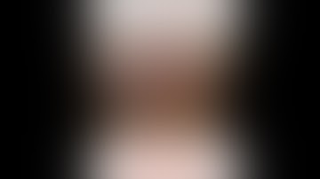 Sốc: Sang Hàn Quốc phẫu thuật cằm gặp biến chứng nghiêm trọng - Hoại tử vì không xử lý kịp thời!