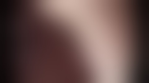 Gắp dị vật thực quản (xương gà)