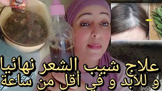 علاج شيب الشعر نهائياوللابد وفي أقل من ساعة،افضل الطرق للتخلص من الشعر الابيض.