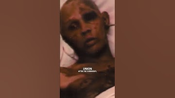Thumbnail of Scary Aftermath: Unveiling Acute Radiation Sickness Photo Post-Chernobyl #shorts