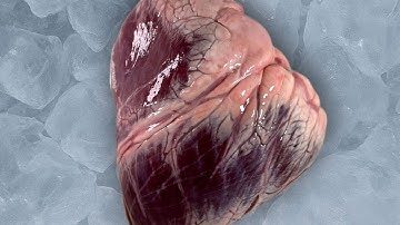 «Органы» Short film (2025) 4K