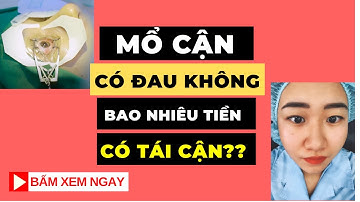 Mổ mắt đau không? Bao nhiêu tiền? Mổ cận lasik? Có HỐI HẬN Không?