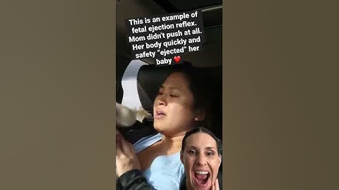 AMAZING CAR BIRTH!!!  Fetal Ejection Reflex!!! #shorts #birth