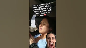 AMAZING CAR BIRTH Fetal Ejection Reflex Shorts Birth 