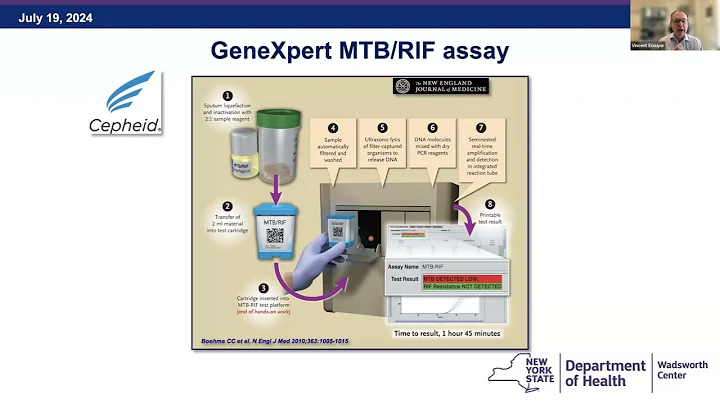2024 TB 101 Series: Interpreting Lab Results