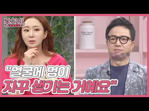   조영구 아내 신재은 두드려 맞고 다니는 조영구 얼굴에 멍이 자꾸 생기는 거예요 MBN 220917 방송