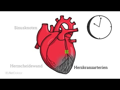 Herzinfarkt sofort erkennen: Auf diese Symptome sollten Sie achten! Typische Anzeichen \u0026 Erste Hilfe