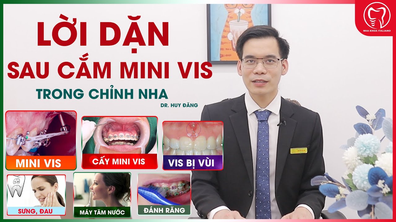 Lời dặn sau cắm mini vis trong chỉnh nha (niềng răng) - YouTube