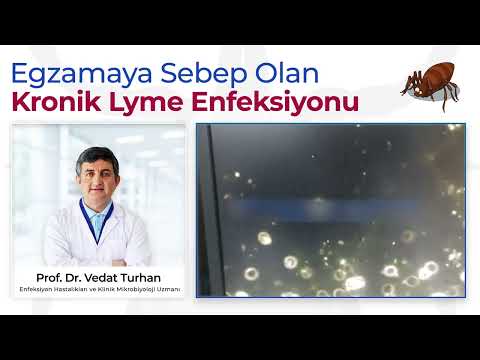 Video: Boyun tutulması Lyme hastalığının bir belirtisi olabilir