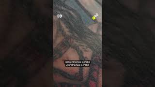 Dövme Yaptırmak Ve Pişman Olmak